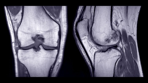 Basic Course for Magnetic Resonance Imaging